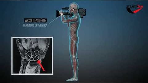 SteadyGum as a solution to camera operator´s