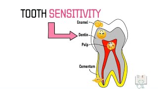 Theories of Dentin Sensitivity/ Hypersensitivity by Doctoropsy 39,133 views 2 years ago 5 minutes, 27 seconds