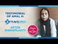 Testimonial of amal h  after rhinoplasty operation