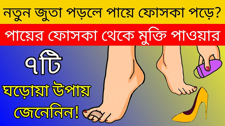 নতুন জুতা পড়ে পায়ে ফোস্কা পড়লে কি করবেন জেনেনিন || পায়ের ঠোসা পড়া থেকে মুক্তি পাওয়ার ঘরোয়া ৭টি উপায়