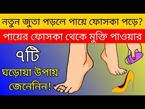 ভিডিও: কীভাবে একটি জাল ক্ষত তৈরি করবেন: 14 টি ধাপ (ছবি সহ)