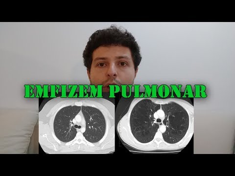 Ce este EMFIZEMUL pulmonar?