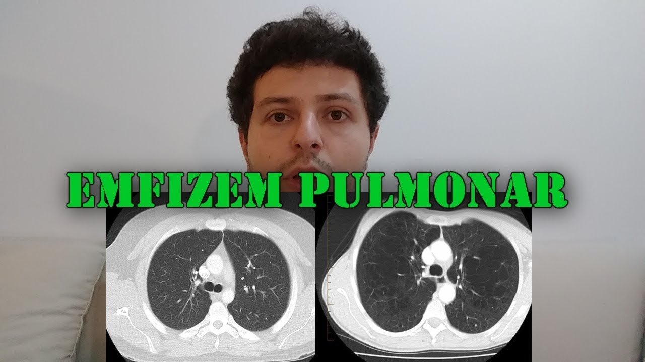hpv virus numbers