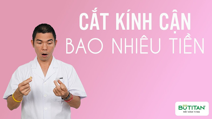 Kính áp tròng cận bao nhiêu tiền năm 2024