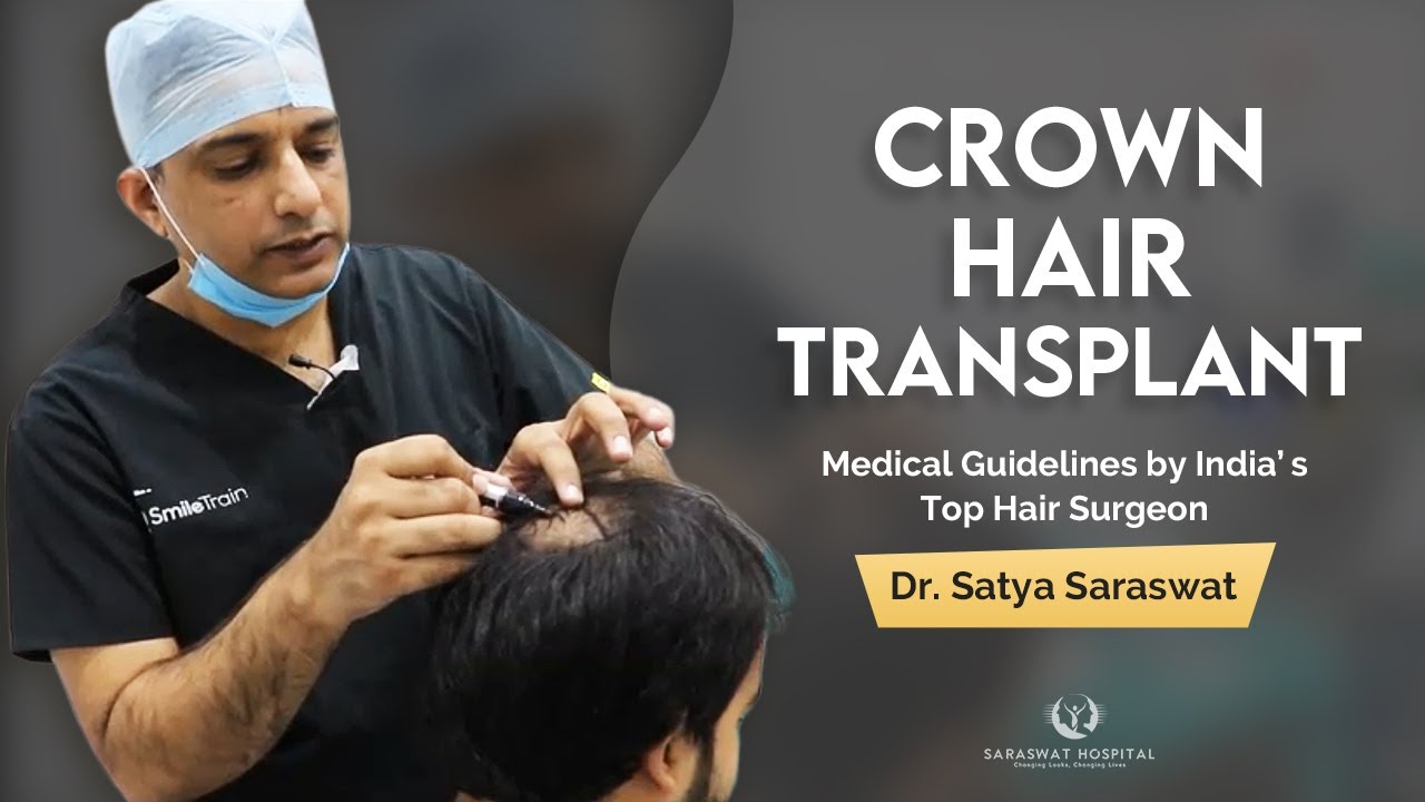 Crown Hair Transplant in India | Medical Guidelines by India's Top Hair  Surgeon-Dr Satya Saraswat - YouTube