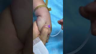 Intramuscular Injection Technique Explained | Safe IM Injection Step-by-Step | Nurse Guide Class 24