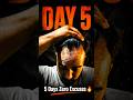 Day 5 - 5 Days No Excuses | Minoxidil Journey | Real Hair Regrowth | Alok Regrows
