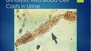 PTA 274 Chapter 18 Lecture Part 1 Urinary System Intro and Diagnostics