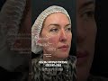 Кейс пациента - естественное омоложение