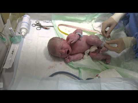 Wideo: Jak Leczyć Dziecko Po Porodzie