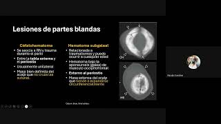 Sesión 28: Casos clínicos TEC Sesión 28: Casos clínicos TEC