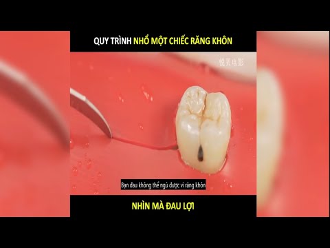 Video: 5 câu chuyện hoang đường về vệ sinh răng miệng