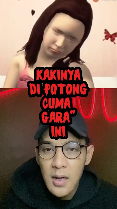 KAKINYA DI AMPUTASI GARA” HAL SEPELE⁉️😱 #shorts #alurcerita #storytime