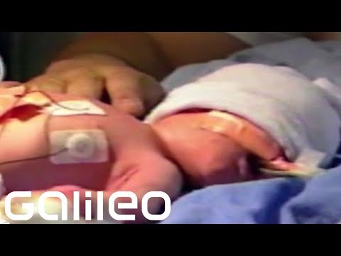 Video: Baby, Das In Chicago Aus Dem Mutterleib Gerissen Wurde, öffnet Die Augen