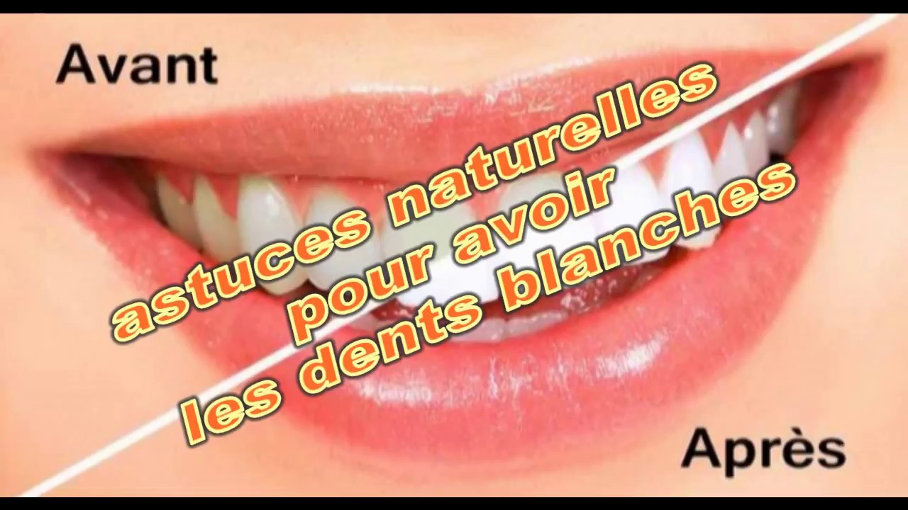 astuces naturelles pour avoir les dents blanches - YouTube