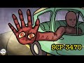 Eyes on Hand SCP-3470 (SCP Animation)