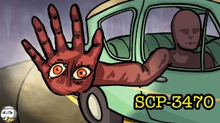 Eyes on Hand SCP-3470 (SCP Animation)