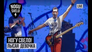 Смотреть клип Ногу Свело! - Лысая Девочка (Live)