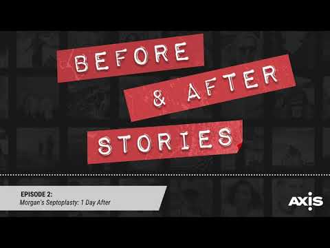 Video thumbnail: Morgan’s Septoplasty: 1 Day After (Before and After Stories - Episode 2) — Before and After Stories
