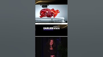 Unlocking the Power of Stem Cells: The Future of Medicine