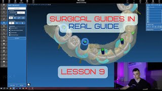 Surgical guides in RealGuide Tutorial. Lesson 9. All on 6 guidee with one-stage tooth extraction