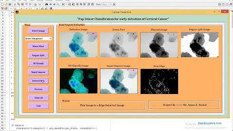 Cervical Cancer Detection using Segmentation of Pap Smear images MATLAB project source code