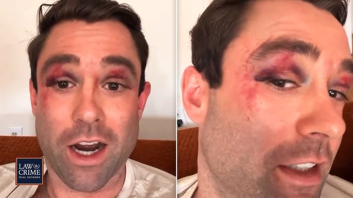 Violent Teens Brutally Beat Fox News Weatherman on NYC Subway