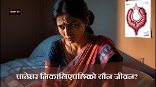 पठघर नकलय भन यन जवन कसत हनछ? Health