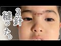 【もう限界】１秒でも目離したら死にます。てんかん/異食/睡眠障害/施設入所？転校？
