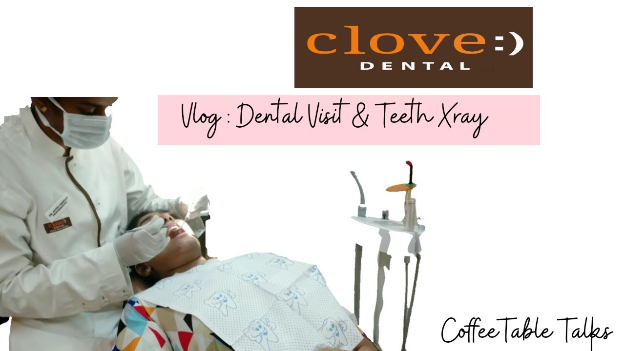 VLOG :TEETH WHITENING கறை படிந்த பற்களை எளிதாக மாற்ற முடியும | CLOVE DENTAL CLINIC VISIT - YouTube