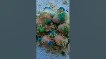 Cat paw full of breadcrumbs! Where has it been walking? Lets #pimplepopping Mochi Pimple Popping