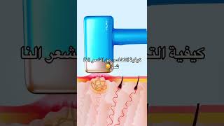 ‎كيفية التخلص من الشعر الناشئshaving mlay T14 laserhairremova ingrownhair ليزر_t14 fyp