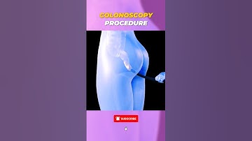 Colonoscopy Procedure Explained in 3D! 🏥 From Prep to Polyp Removal | US & UK Med Students #facts