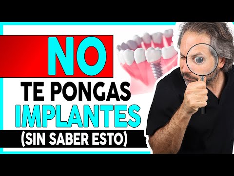 Video: Tres formas de elegir un dentista pediátrico