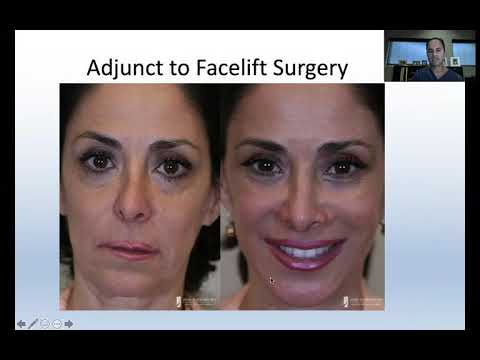 Chin Augmentation: Selecting Between a Chin Implant or Sliding Genioplasty to Improve Facial Harmony