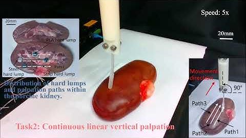 Multifunctional magnetic catheter robot with triaxial force sensing for surgery  Movie S1