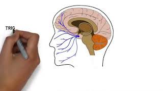 2-Minute Neuroscience: Migraine #neuroscience