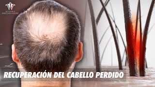 La ciencia de la caída de PELO: ¿Cómo solucionarla?