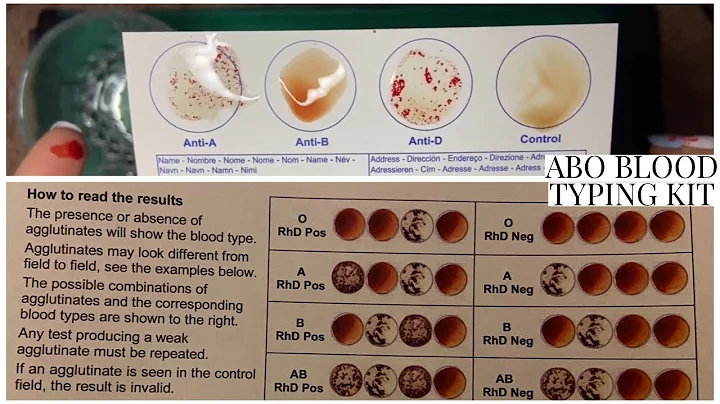 BLOOD TYPING WITH THE ELDON CARD |