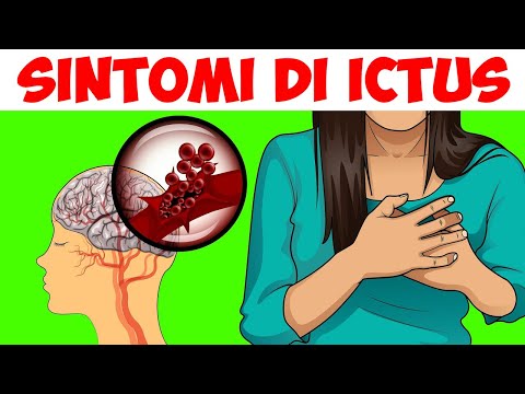 Video: La Malattia Di Bechterew - Trattamento, Sintomi Nelle Donne E Negli Uomini