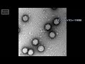 世界初の食道がん治療薬を了承　「ウイルス」でがん細胞を破壊(2026年5月22日)