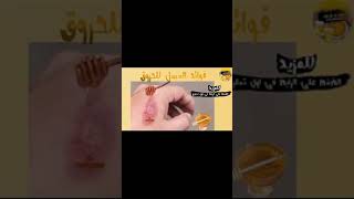 فائدة العسل للحروق