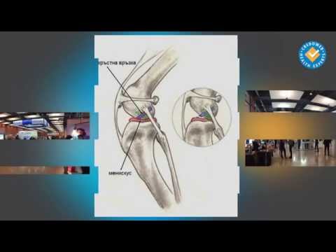 Видео: Страничен колатерален лигамент навяхване и нараняване