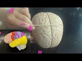 Brain Anatomy Quiz
