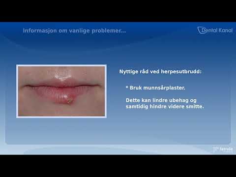 Video: Den mest effektive salven for herpes på leppene