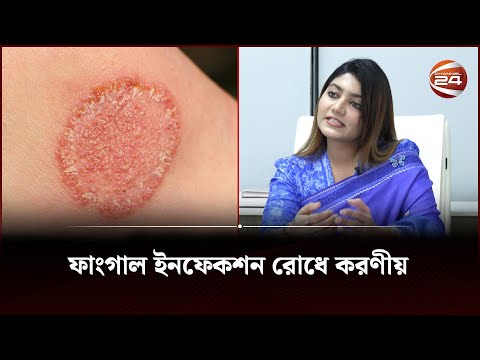 ফাংগাল ইনফেকশন রোধে করণীয় | Fungal infection | Channel 24