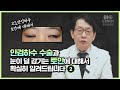 토안이 생기는 고도안검하수 어떤점을 고려해서 수술을 해야 하는지 자세히 알려드리겠습니다.