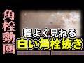 【 角栓抜き動画 】白い角栓をただ抜くだけの動画～A video of simply removing white blackheads