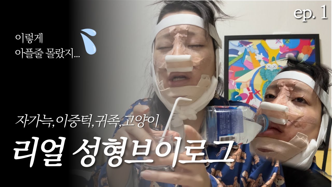 EP.1 자가늑 코수술하신분들 존경합니다. 생긴대로 삽시다 걍