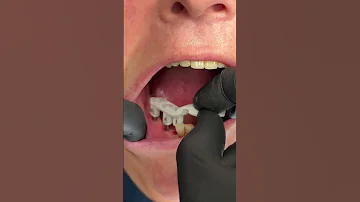 Wie kann ich meine Zähne bezahlen?